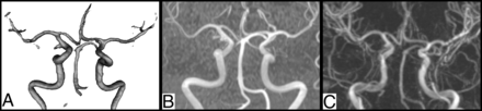 FIG 2.