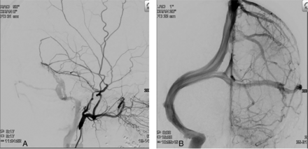 FIG 1.