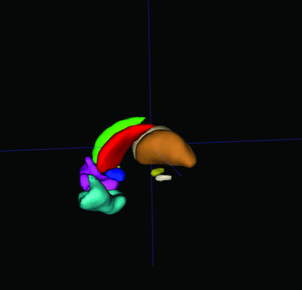 FIG 1.