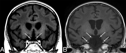 FIG 2.
