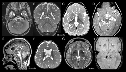 FIG 1.