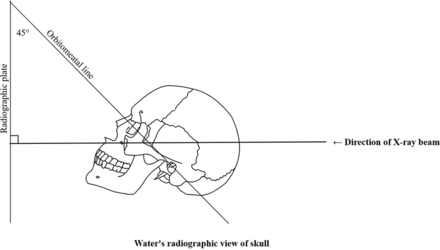 FIG 1.