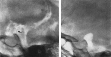 FIG 1.