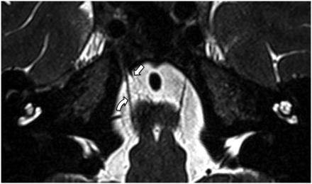 FIG 11.