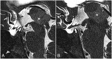 FIG 12.
