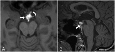 FIG 13.