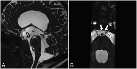 FIG 14.