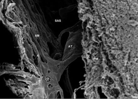 FIG 2.