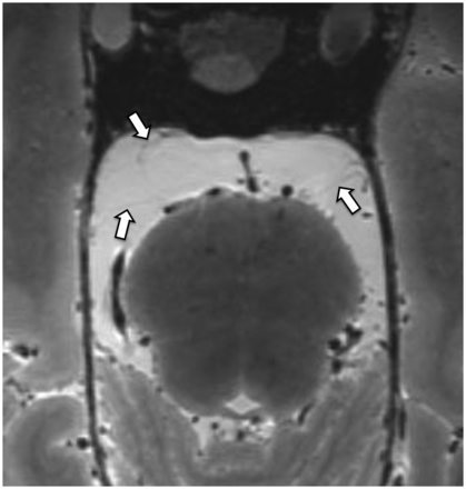 FIG 3.