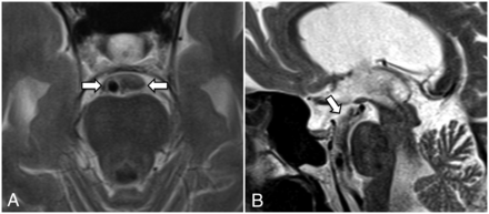 FIG 4.