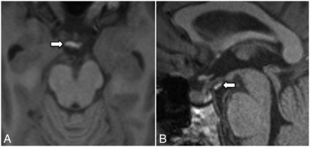 FIG 5.