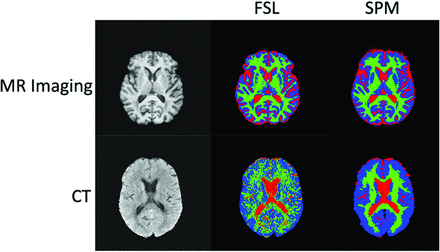 FIG 1.