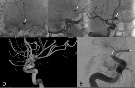 FIG 5.