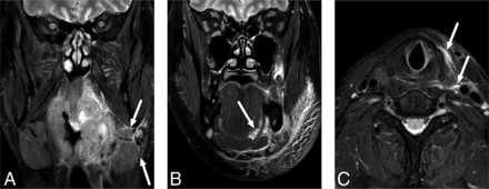 FIG 4.