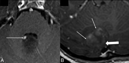 FIG 2.