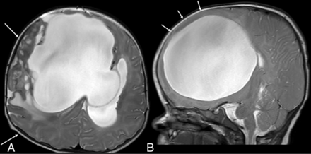 FIG 4.