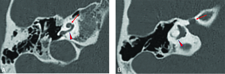 FIG 1.
