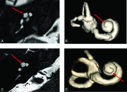 FIG 3.