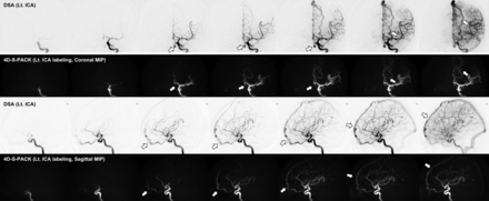 FIG 5.