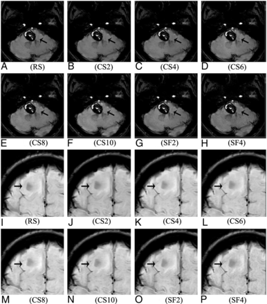 FIG 3.