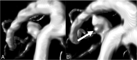 FIG 2.