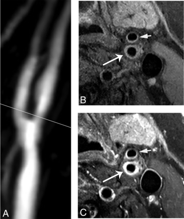 FIG 3.