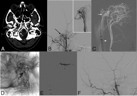 FIG 1.