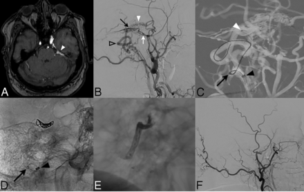 FIG 3.