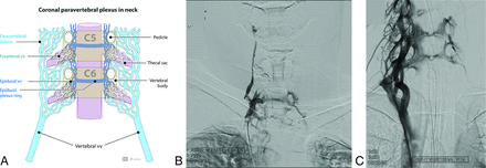 FIG 4.