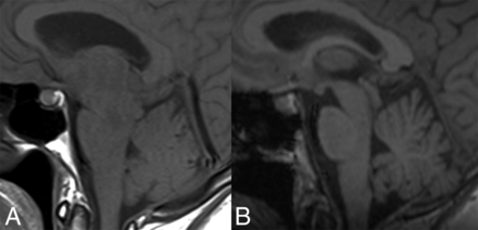 FIG 3.