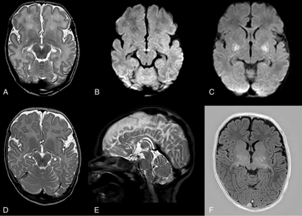 FIG 2.