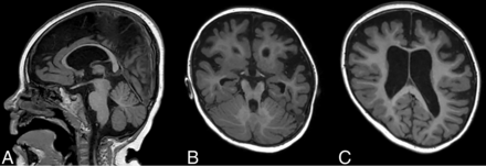 FIG 3.
