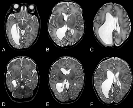 FIG 6.