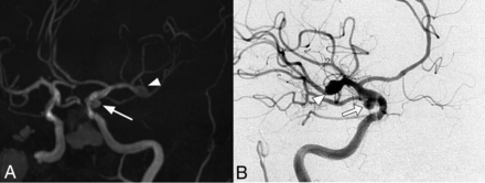 FIG 2.