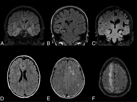 FIG 1.