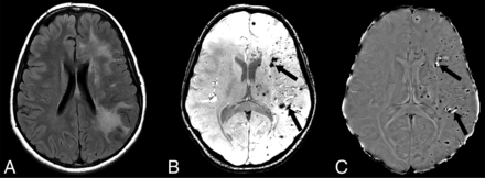 FIG 2.