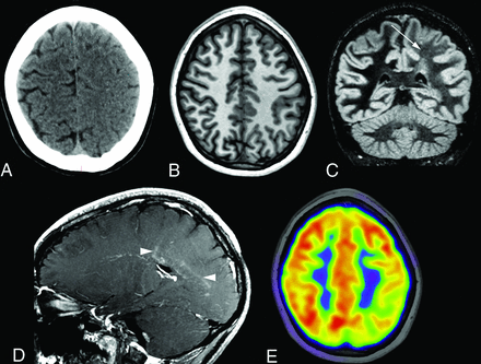 FIG 4.