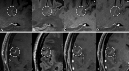 FIG 3.