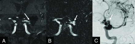 FIG 2.