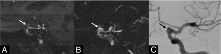 FIG 3.