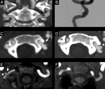 FIG 1.