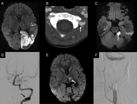 FIG 2.