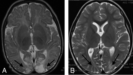 FIG 3.