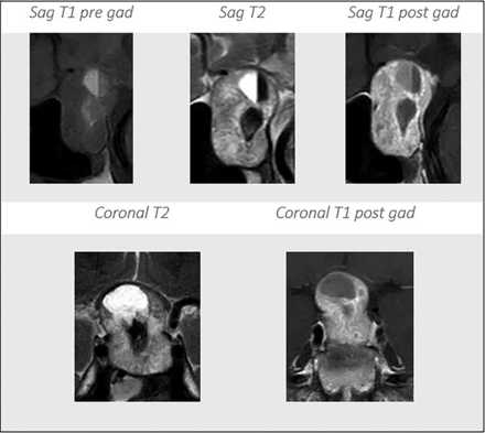 FIG 4.