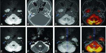 FIG 1.