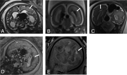FIG 1.