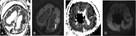 FIG 3.
