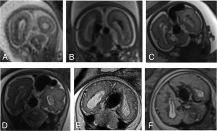 FIG 4.