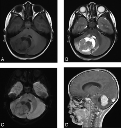 FIG 1.
