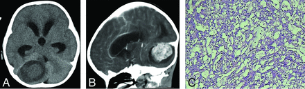 FIG 3.